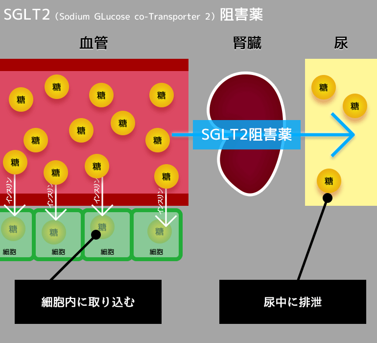 SGLT2（Sodium GLucose co-Transporter 2）阻害薬