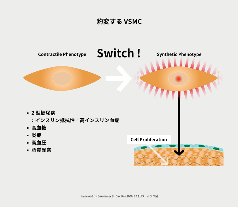 豹変するVSMC