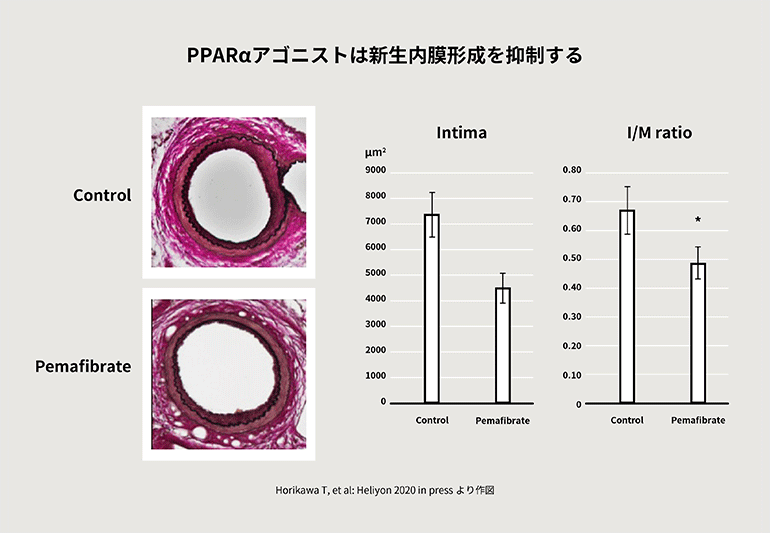 PPARαアゴニストは新生内膜形成を抑制する＠第29話 残存リスクを打つべし！＠糖キング　野見山崇